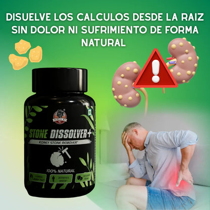 Descubre la Solución Natural Nº1 para Disolver y Expulsar los Cálculos Sin Dolor.