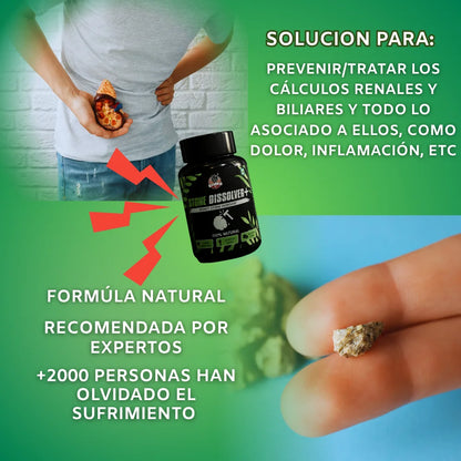 Descubre la Solución Natural Nº1 para Disolver y Expulsar los Cálculos Sin Dolor.