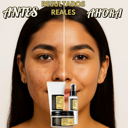 ¡El Rescate de tu Piel! La Rutina COSRX de 3 Pasos que Calma la Sequedad, Borra Manchas y Controla el Acné.