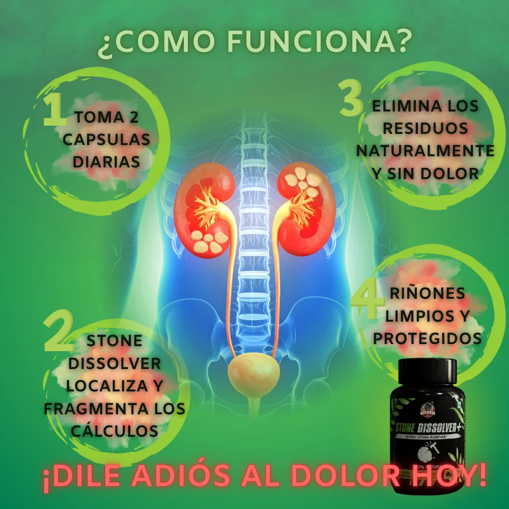 Descubre la Solución Natural Nº1 para Disolver y Expulsar los Cálculos Sin Dolor.