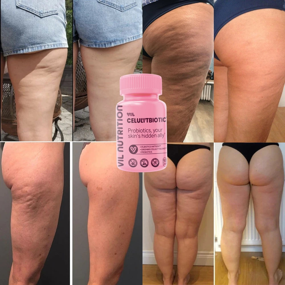 Deja de cubrirte por miedo a la celulitis empieza a lucir tu piel con orgullo