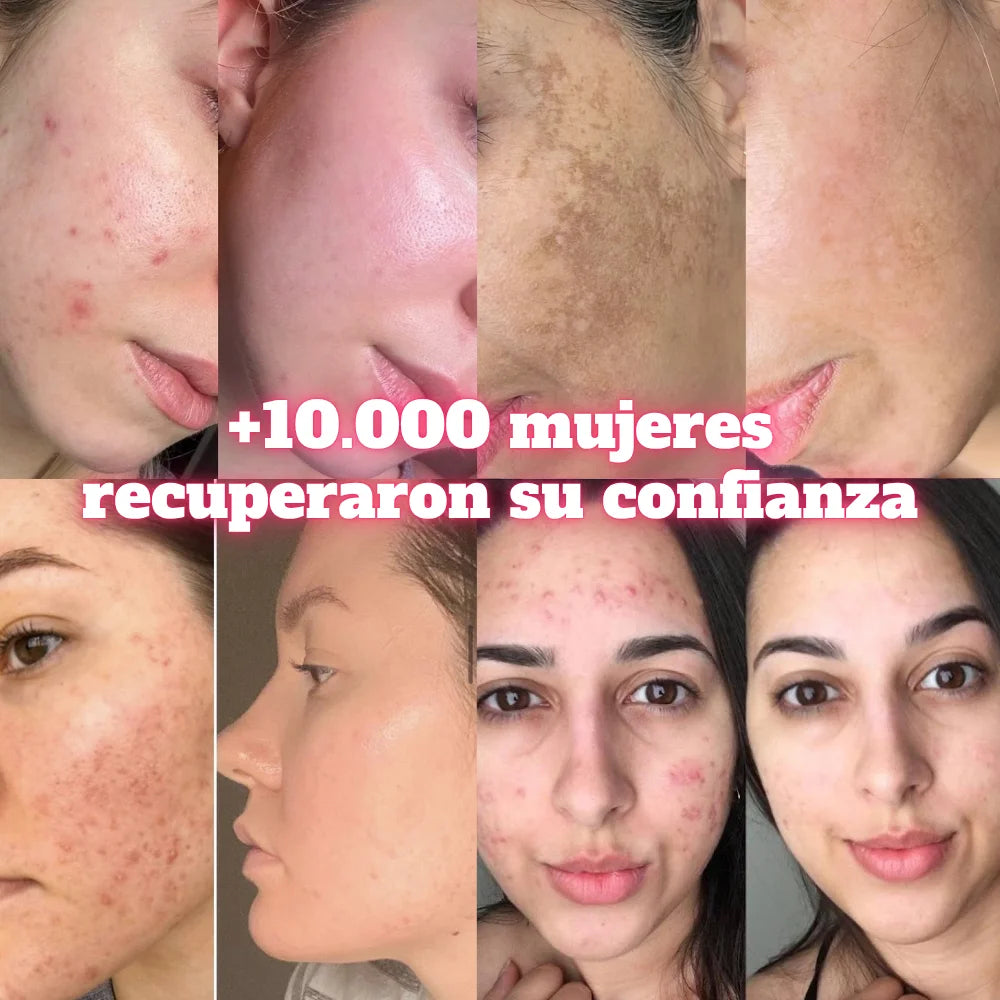 ¿Sientes que tu piel ya no refleja la juventud que tienes por dentro?