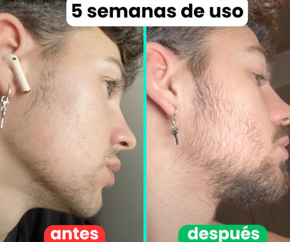 Bálsamo para Crecimiento de Barba Ultra Potente con Minoxidil 20% | 100mL